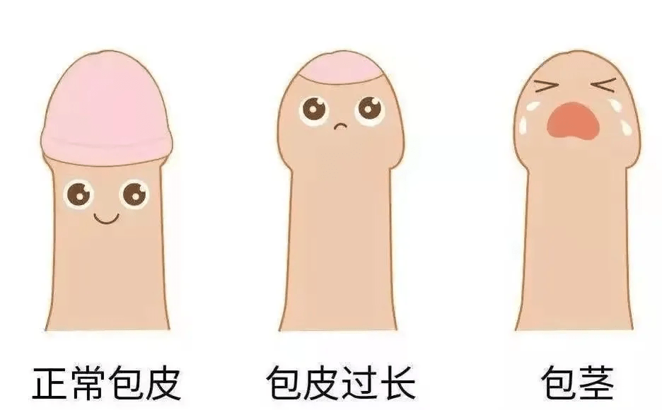 南京去哪割包皮?南京邦德中医院专业吗?