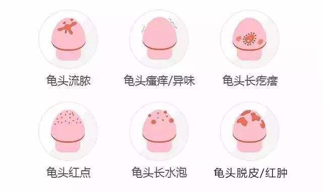 男性常发的龟头炎都有哪些病因呢？