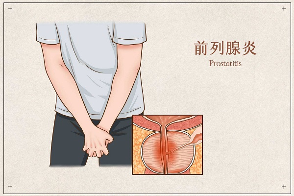 南京邦德中医院解答：前列腺炎的诱发因素有哪些呢？