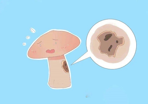 龟头上有白色物体怎么回事？